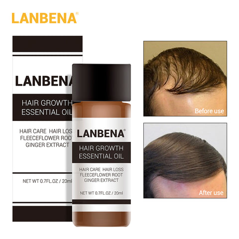 LANBENA Fast Powerful Hair Growth Oil Treatment Preventing Hair Loss