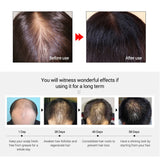 LANBENA Fast Powerful Hair Growth Oil Treatment Preventing Hair Loss